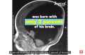 Noah the miracle - Boy born with just 2% brain